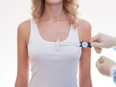 Brustvergrößerung mit Implantaten – Die beste Wahl für ein harmonisches Körperbild